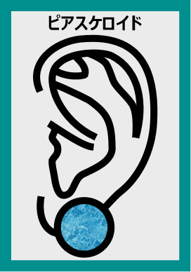 maha28510101002538 keloid